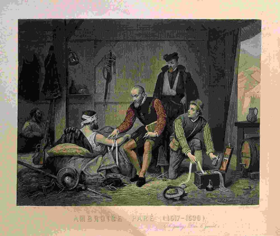 Ambroise Pare facts include that Ambroise Pare was a celebrated physician of military medicine and novel surgical techniques.