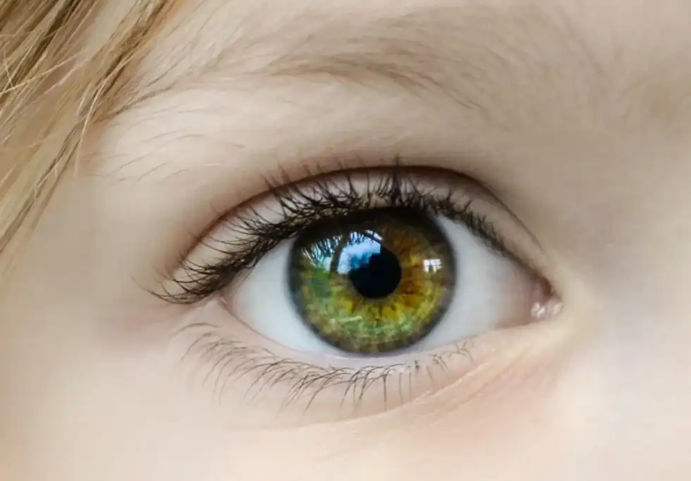Hazel eyes are one of the rarest eye colors.