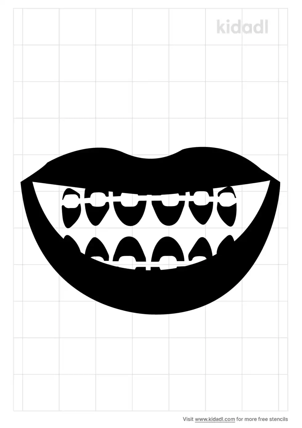 Smile Braces Stencil