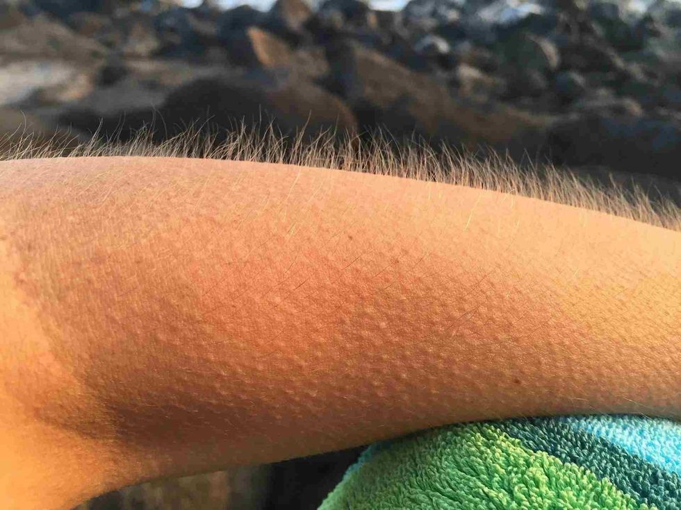 Must know amazing facts about goosebumps.