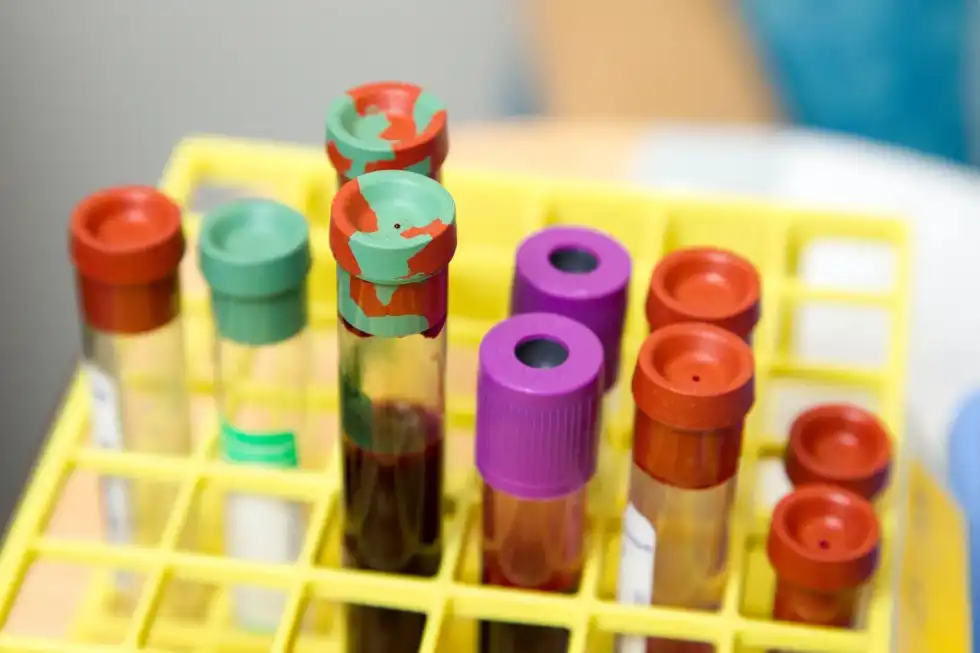 O blood type facts will make you understand the importance of this particular type of blood group.