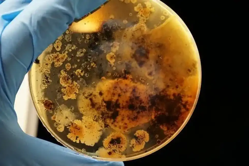 Parasitism facts are all about the vast range of parasites that exist in the world.