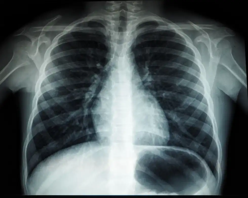 The shadow images on photographic plates are captured in black and white which helps doctors to inspect problems that are occurring internally. Let's find more X-ray facts.