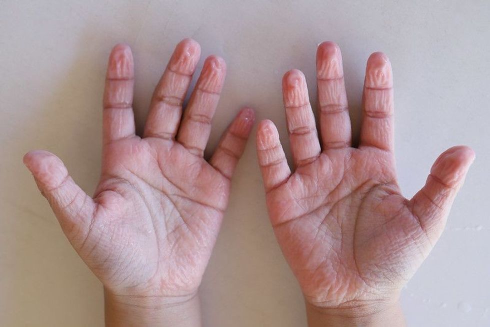 Wrinkled hands
